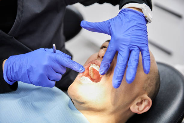 Best Dentist for Tooth Abscess  in Albany, WI