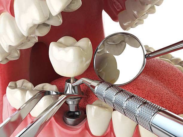 Best Urgent Tooth Repair  in Albany, WI